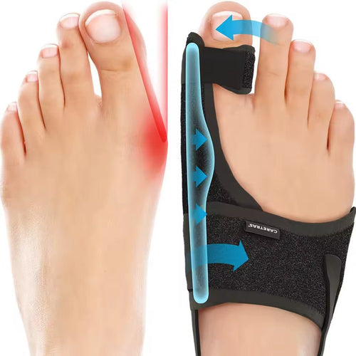 Wearclo | Night Splint Hallux Valgus - Ergonomic and Adjustable Comfort 0